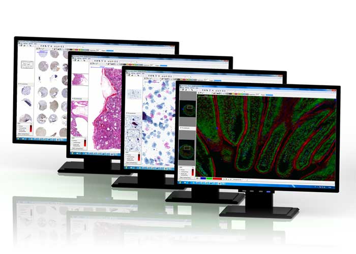 Digital patologi er fremtiden – les mer om 3DHISTECH