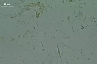 1200x800px-microalgae-3.webp