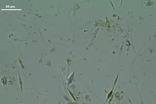 1200x800px-microalgae-2.webp